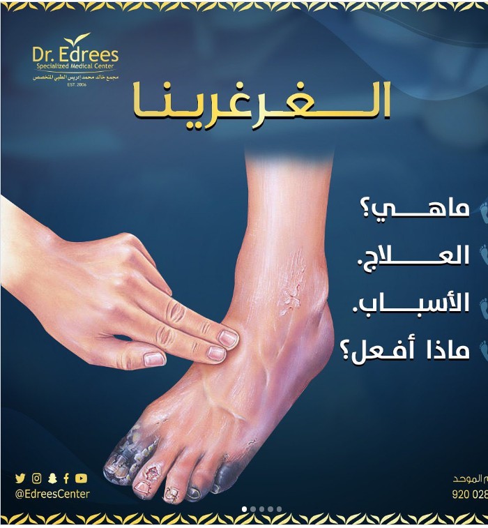 الغرغرينا