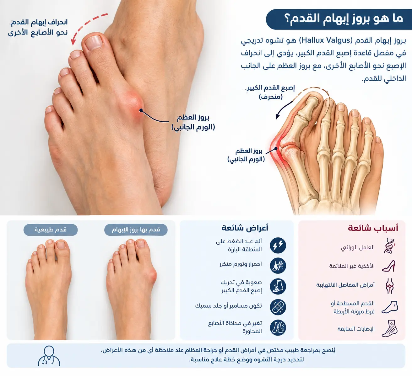 علاج بروز إبهام القدم: من التمارين إلى الجراحة